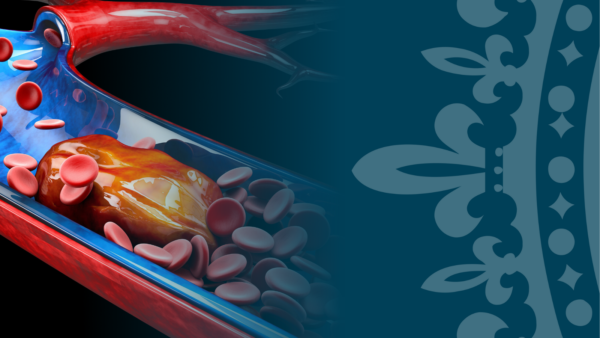Clinical update on venous thromboembolism: from diagnosis and treatment